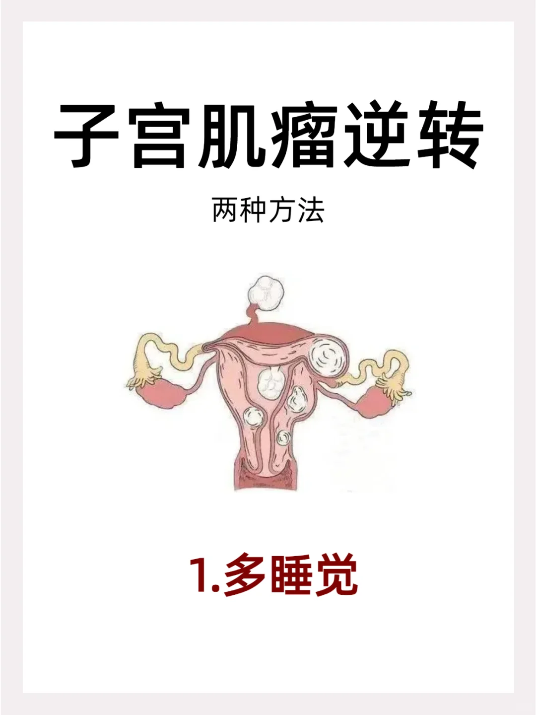 孙思邈：子宫肌瘤逆转与辅助生殖指南