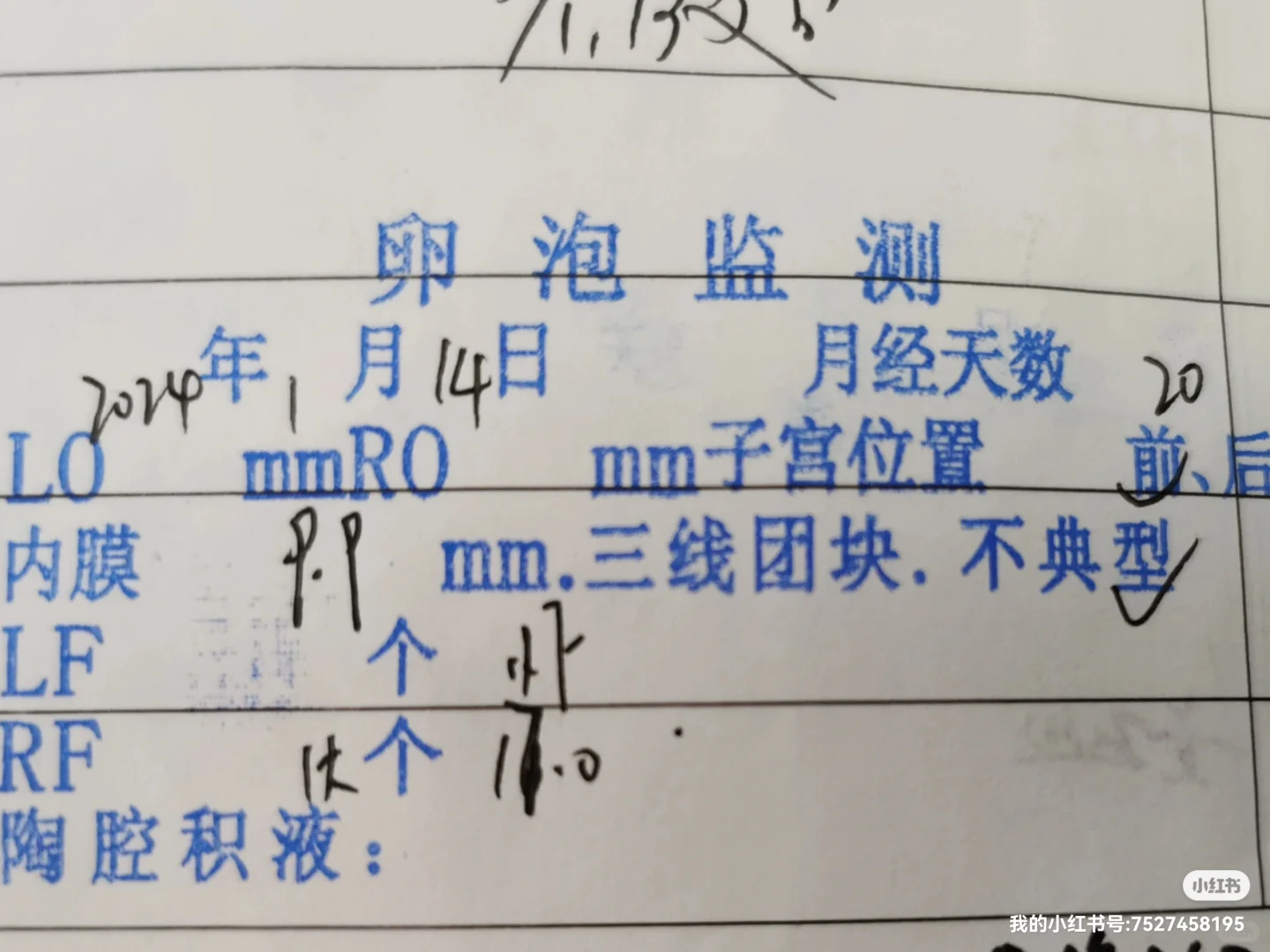 #同济#解读同济的卵泡监测单,做试管代孕去哪里