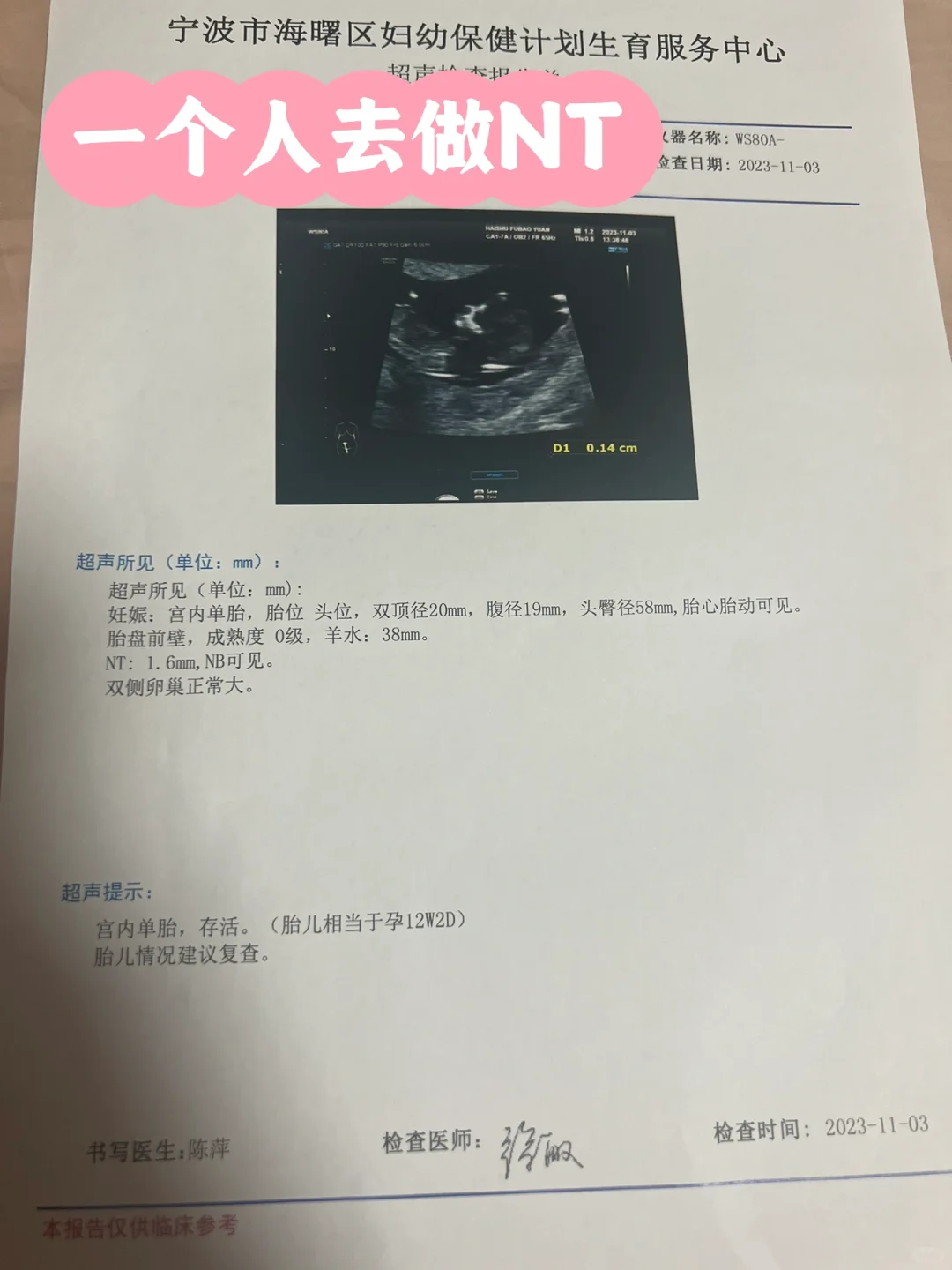 孕12+2周独自NT检查一次通过经验分享