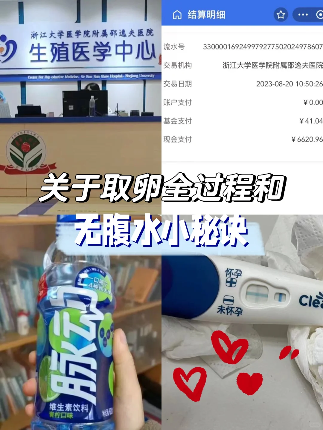 取卵全过程分享与避免腹水小贴士，助孕经验解析